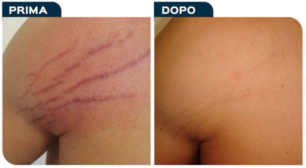 caso03