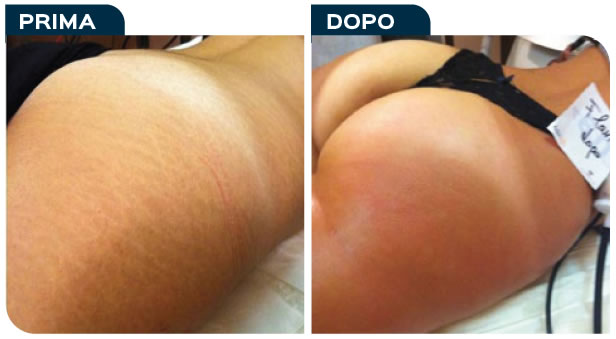 caso05