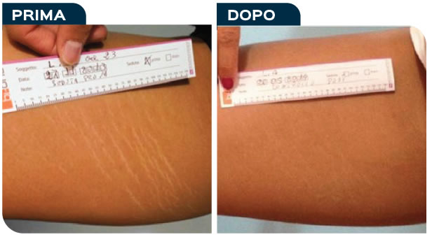 caso08