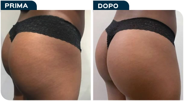 esempio01-02